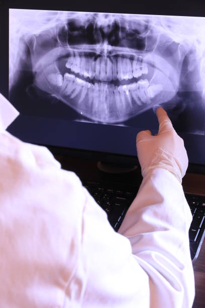 Best Emergency Treatment for Dental Infections or Abscesses in Paonia, CO
