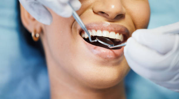 Best Emergency Gum Treatment in Paonia, CO