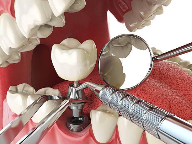 Best Emergency Denture Repair in Paonia, CO
